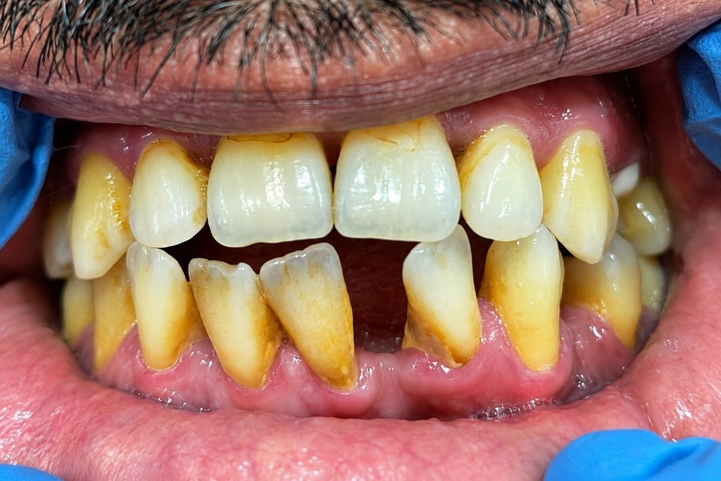 Smile Before Treatment